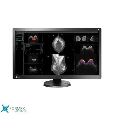 Medische Monitoren van Formex Medical: EIZO RX370 RadiForce