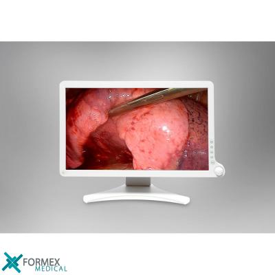 Barco AMM 215WTD: Full HD 21,5-inch chirurgisch display