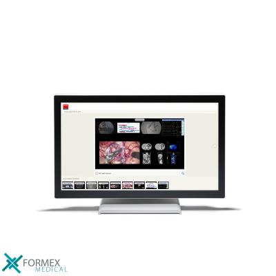 Medische Monitoren: Barco AMM 215WTTP