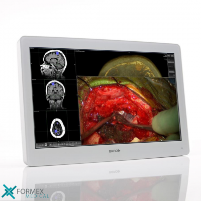 Monitoren voor op de operatiekamer: MDSC-2324