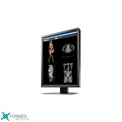 Medical displays bij Formex Medical: Eizo MX216-SB RadiForce