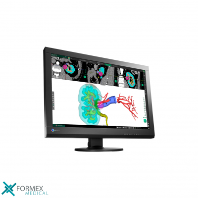 Medical displays: Eizo MX242W 24-inch DICOM-Preset-monitor