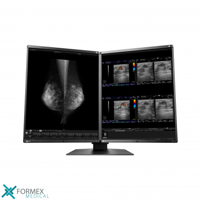 Diagnostiek Medische Monitoren: Eizo RX560-MD RadiForce MammoDuo