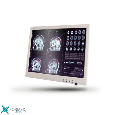 Onyx 1731: Fanless Slim Medical all-in-one pc