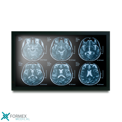 Onyx 22 inch dun medisch display