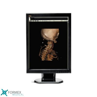 Medical displays: Wide CX20 digitale radiologie, echografie.